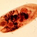 Metagonimus yokogawai, kleiner Darmegel aus der Gruppe der Saugwürmer