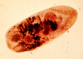 Metagonimus yokogawai, kleiner Darmegel aus der Gruppe der Saugwürmer