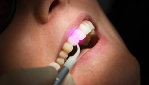 Laserbehandlung beim Zahnarzt - apotheken-wissen.de