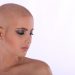 Haarausfall durch Chemotherapie